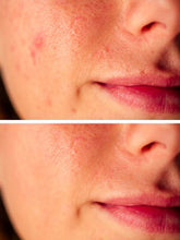 Charger l&#39;image dans la galerie, Perfect skin
