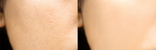 Charger l&#39;image dans la galerie, Perfect skin
