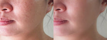 Charger l&#39;image dans la galerie, Perfect skin
